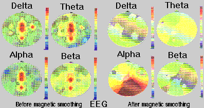 EEG mapping before and after magnetic smoothing